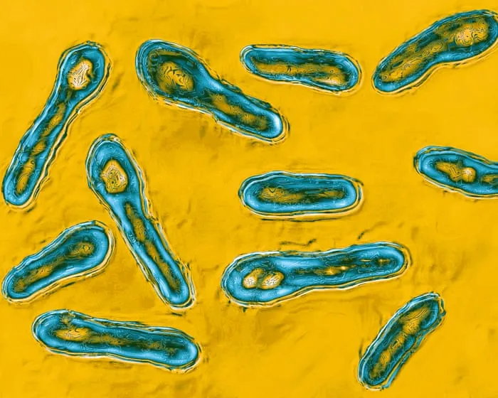 New York City med spa owner admits to giving client botulism with bootleg Botox
